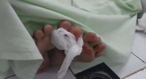 Polisi Ungkap Hasil Pemeriksaan Forensik Korban Pembunuhan di Cibadak