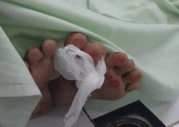 Polisi Ungkap Hasil Pemeriksaan Forensik Korban Pembunuhan di Cibadak