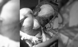 Kondisi Terkini Korban Pembacokan Sadis di Ciambar Sukabumi, RS Sekarwangi Kerahkan 3 Dokter Spesialis