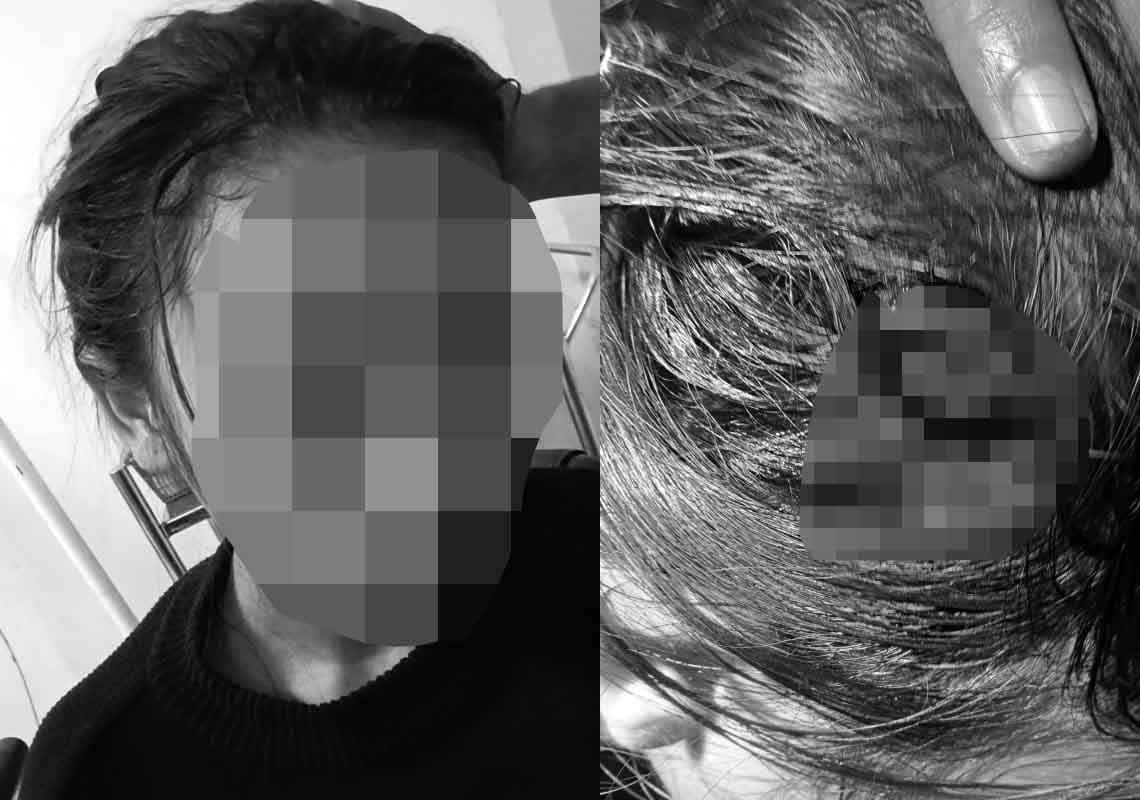 Minta Tanggung Jawab Karena Hamil, ABG Bojonggenteng Sukabumi Disiksa Pacar, Kepala Dibanting ke Aspal