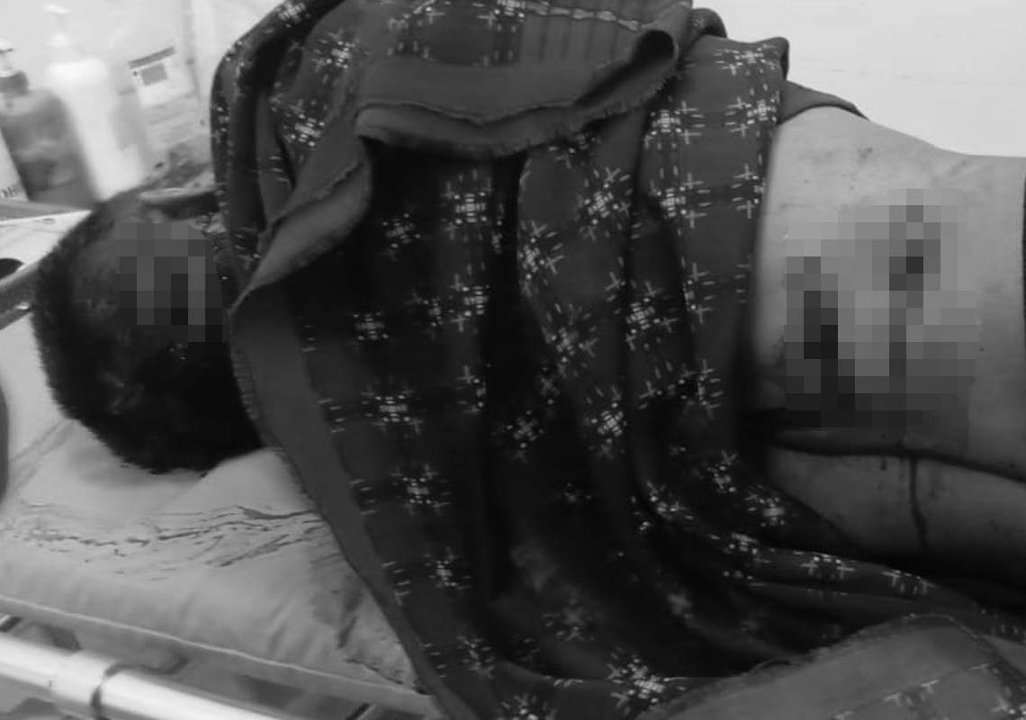 Pembacokan Sadis Terjadi di Ciambar Sukabumi, Korban Kritis