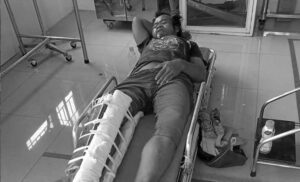 Pemotor Ibu-ibu Tabrak ODGJ di Surade Sukabumi