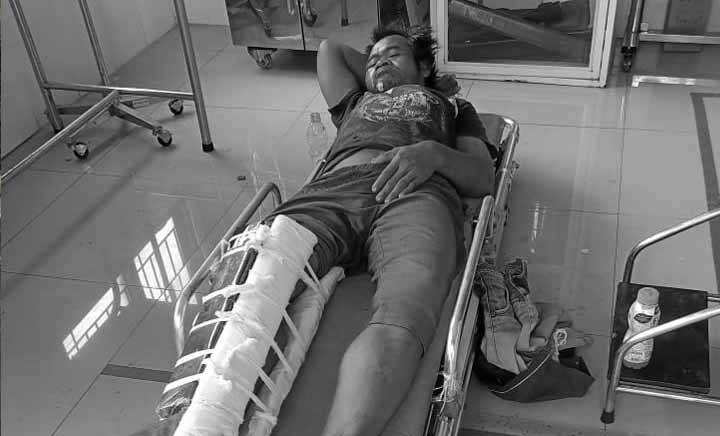 Pemotor Ibu-ibu Tabrak ODGJ di Surade Sukabumi