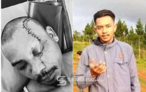 SADIS! Tolak Diajak Menagih Utang, Pekerja Kebun di Takokak Dibacok dan Divideoin Pelaku Saat Sekarat